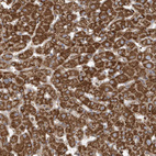 Immunohistochemical staining of human Liver shows strong granular cytoplasmic positivity in hepatocytes.