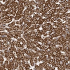 Immunohistochemical staining of human Liver shows strong granular cytoplasmic positivity in hepatocytes.