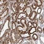 Immunohistochemical staining of human Kidney shows strong granular cytoplasmic positivity in cells in tubules.