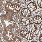 Immunohistochemical staining of human Rectum shows strong granular cytoplasmic positivity in glandular cells.