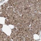 Immunohistochemical staining of human Pancreas shows moderate granular cytoplasmic positivity in exocrine glandular cells.