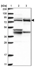 Lane 1: Marker [kDa] 230, 130, 95, 72, 56, 36, 28, 17, 11_br/_Lane 2: Human cell line RT-4_br/_Lane 3: Human cell line U-251MG sp