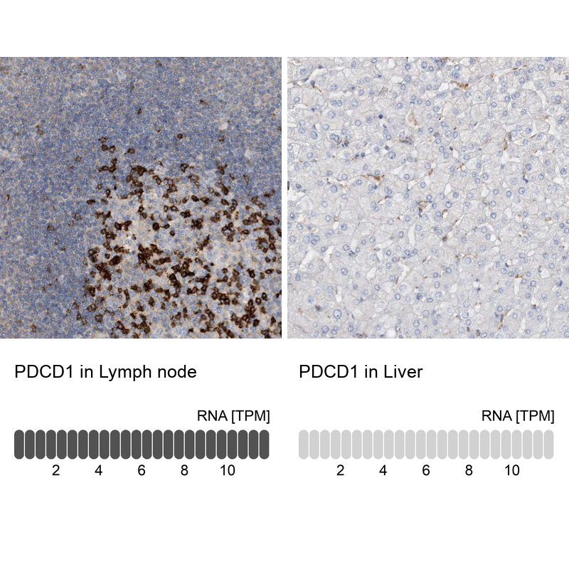Anti-PDCD1 Antibody
