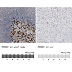 Anti-PDCD1 Antibody