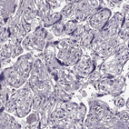 Immunohistochemical staining of human placenta shows no positivity in trophoblastic cells as expected.