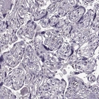 Immunohistochemical staining of human placenta shows no positivity in trophoblastic cells as expected.