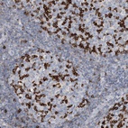 Immunohistochemical staining of human tonsil shows strong cytoplasmic positivity in germinal center cells.
