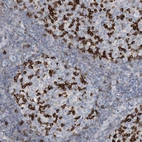 Immunohistochemical staining of human tonsil shows strong cytoplasmic positivity in germinal center cells.