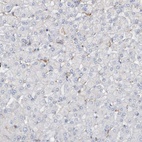 Immunohistochemical staining of human liver shows no positivity in hepatocytes as expected.