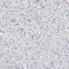 Anti-PDCD1 Antibody