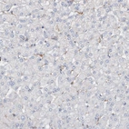 Immunohistochemical staining of human liver shows no positivity in hepatocytes as expected.