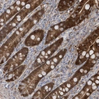Anti-BDH2 Antibody