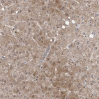 Immunohistochemical staining of human liver shows moderate cytoplasmic positivity in hepatocytes.