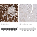 Immunohistochemistry analysis in human kidney and skeletal muscle tissues using HPA036028 antibody. Corresponding BDH2 RNA-seq data are presented for the same tissues.