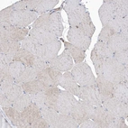 Immunohistochemical staining of human skeletal muscle shows weak positivity in myocytes as expected.
