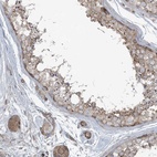 Anti-PIK3R4 Antibody
