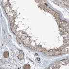 Anti-PIK3R4 Antibody