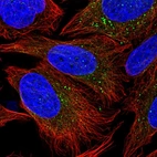Immunofluorescent staining of human cell line U-2 OS shows localization to vesicles.