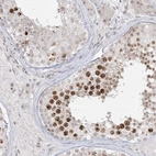 Anti-PTK6 Antibody