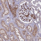 Anti-TNS1 Antibody