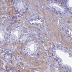 Anti-TNS1 Antibody