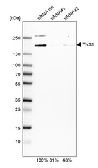 Anti-TNS1 Antibody