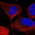 Immunofluorescent staining of human cell line U-2 OS shows localization to midbody ring.