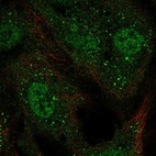 Anti-KCNAB1 Antibody