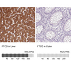 Anti-FTCD Antibody