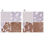 Immunohistochemical staining of human cerebral cortex, colon, kidney and liver using Anti-FTCD antibody HPA036114 (A) shows similar protein distribution across tissues to independent antibody HPA030928 (B).