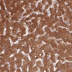 Immunohistochemical staining of human liver shows strong cytoplasmic positivity in hepatocytes.