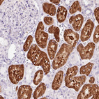 Immunohistochemical staining of human kidney shows strong cytoplasmic positivity in cells in tubules.