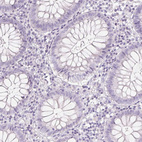 Immunohistochemical staining of human colon shows no cytoplasmic positivity in glandular cells as expected.