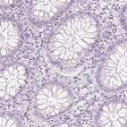 Immunohistochemical staining of human colon shows no cytoplasmic positivity in glandular cells as expected.