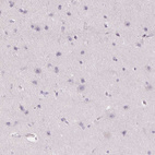 Immunohistochemical staining of human cerebral cortex shows no cytoplasmic positivity in neuronal cells as expected.