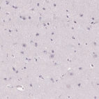 Immunohistochemical staining of human cerebral cortex shows no cytoplasmic positivity in neuronal cells as expected.