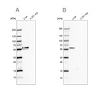 Western blot analysis using Anti-FTCD antibody HPA036114 (A) shows similar pattern to independent antibody HPA030928 (B).