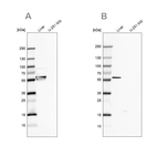 Western blot analysis using Anti-FTCD antibody HPA036114 (A) shows similar pattern to independent antibody HPA030928 (B).