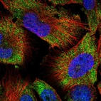 Immunofluorescent staining of human cell line U-251 MG shows localization to cytosol.