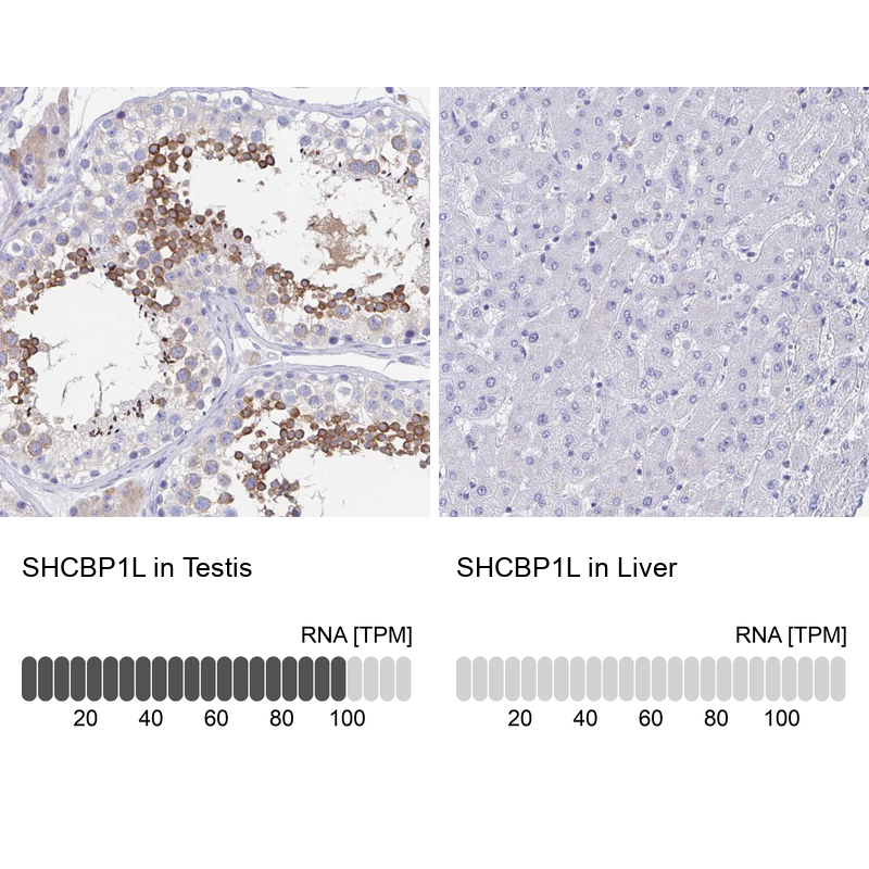 Anti-SHCBP1L Antibody