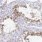 Immunohistochemical staining of human testis shows moderate cytoplasmic positivity in subset of cells in seminiferous ducts.