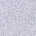 Immunohistochemical staining of human liver shows no positivity in hepatocytes as expected.