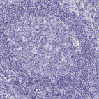 Immunohistochemical staining of human lymph node shows no positivity in germinal center cells as expected.