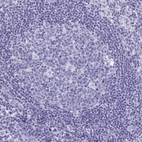 Immunohistochemical staining of human lymph node shows no positivity in germinal center cells as expected.