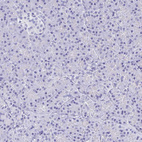 Immunohistochemical staining of human pancreas shows no positivity in exocrine glandular cells as expected.