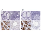 Immunohistochemical staining of human colon, lymph node, salivary gland and testis using Anti-PRR27 antibody HPA036150 (A) shows similar protein distribution across tissues to independent antibody HPA036151 (B).