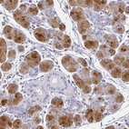 Immunohistochemical staining of human salivary gland shows high expression.