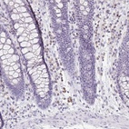 Immunohistochemical staining of human colon shows low expression as expected.