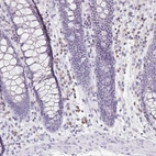 Immunohistochemical staining of human colon shows low expression as expected.