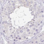 Immunohistochemical staining of human testis using Anti-PRR27 antibody HPA036150.